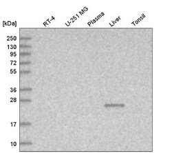 TTC36 Antibody, Novus Biologicals 25 &mu;L | Buy Online | Novus Biologicals | Fisher Scientific